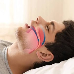 Read more about the article Sleep Apnea and When to See an ENT Specialist | NY Institute of Otolaryngology